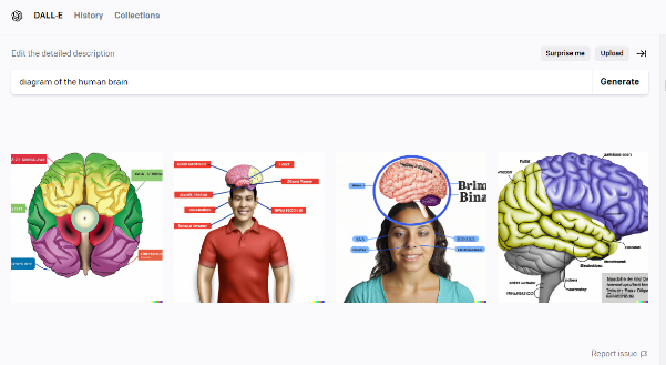 Diagram of the human brain